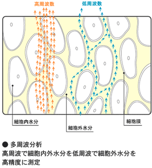 多周波分析　高周波で細胞内外水分を低周波で細胞外水分を高精度に測定